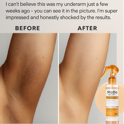 Peel Shot™ Kojic + Turmeric Exfoliating Body Spray